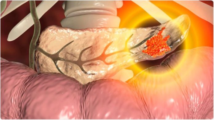 Cancer-gastrointestinal-768x433