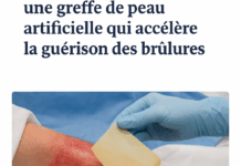 Des chercheurs israéliens innovent : une greffe de peau artificielle qui accélère la guérison des brûlures