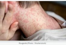 Nouvelle tragédie en Israël : un enfant de 18 mois non vacciné meurt de la rougeole, dixième victime de l’année