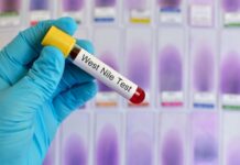 L’Organisation mondiale de la santé met en garde : une épidémie du virus Marburg approche