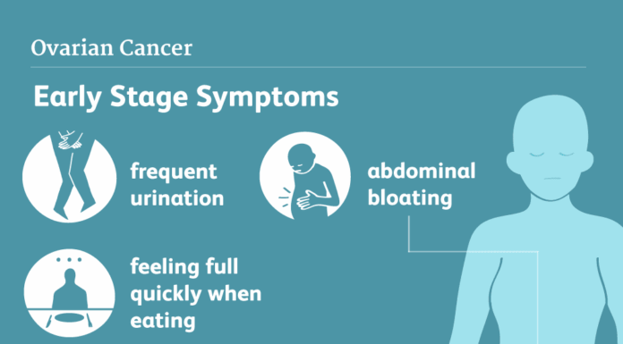 Le cancer de l’ovaire, ce tueur silencieux que personne ne regarde : pourquoi des milliers de femmes sont encore diagnostiquées trop tard