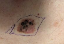 Petah Tikva : Le vétéran de Tsahal vient acheter une crème pour la peau – la pharmacienne lui sauve la vie