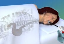 EndoZip : la startup israélienne qui rétrécit l’estomac sans chirurgie et fait perdre 13% du poids en un an