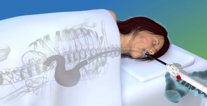 endozip-scsh-1024x527